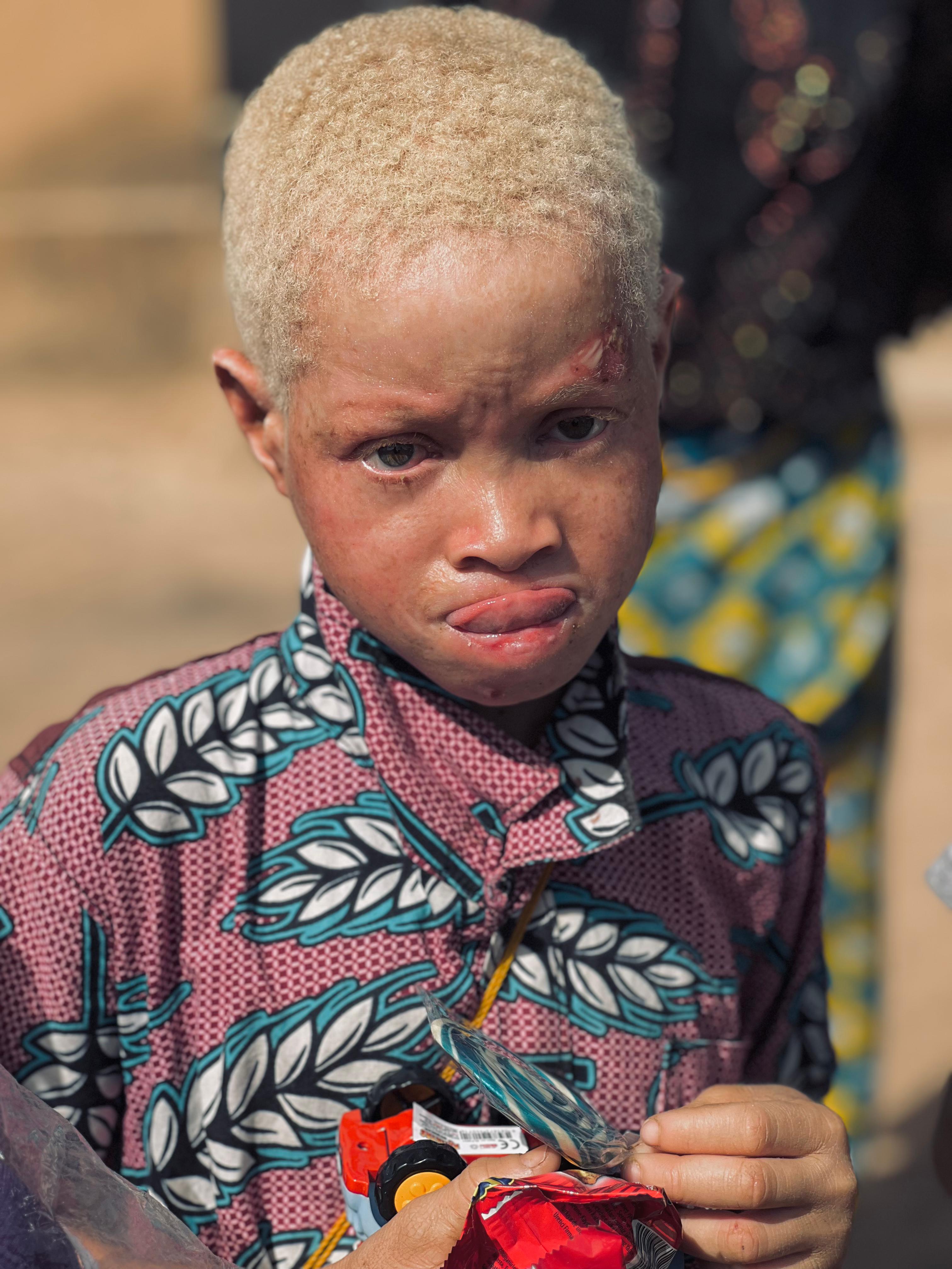 Bir Sarılma Yeter - 3